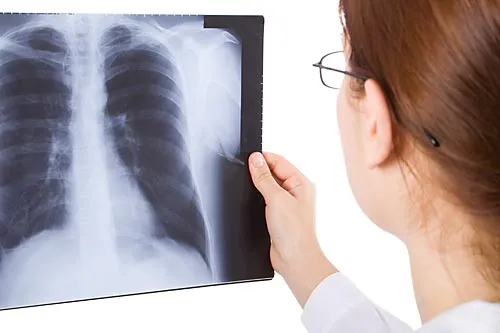 Туберкулез в Петербурге не побежден | Иллюстрация StockPhotosArt/shutterstock.com 